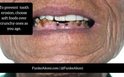 6 Helpful Tips to Prevent Teeth Issues Associated with Aging