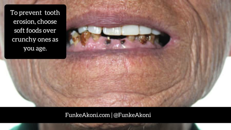 Tooth issues in older people